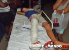 Crian�a fratura a perna ap�s  ser atropelada por motociclista, em Ji-Paran�